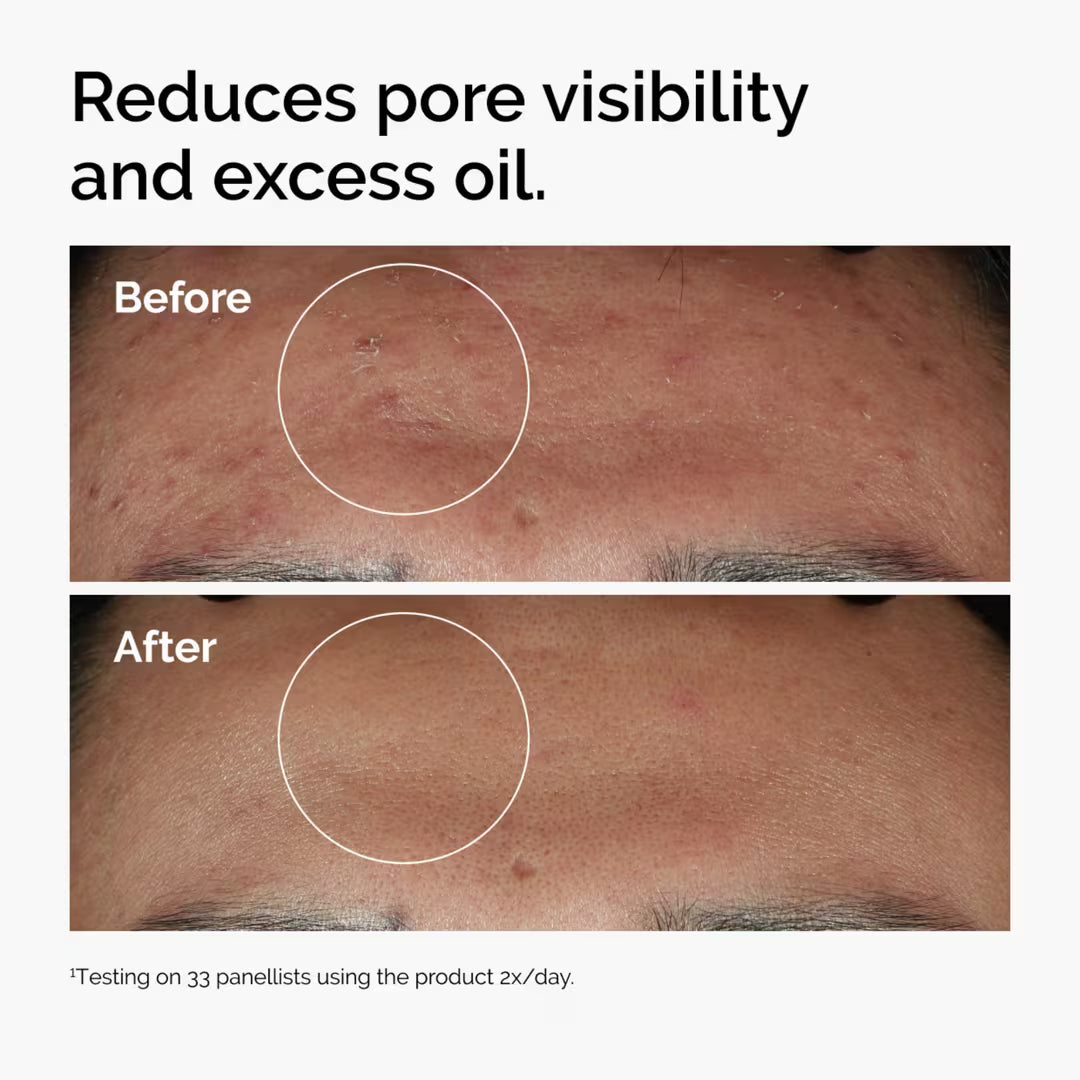 The Ordinary Niacinamide 10% Zinc 1%