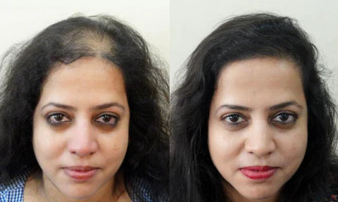 Adivasi Neelabari Herbal Hair Oil