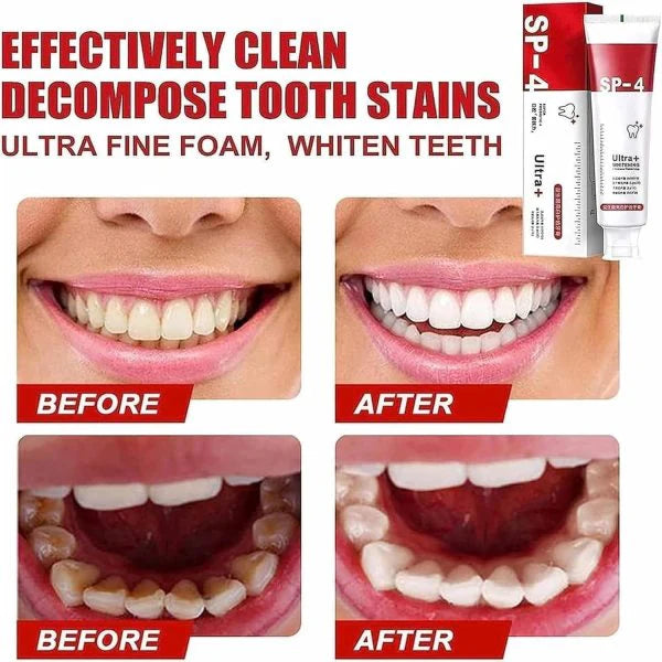 SP-4 ULTRA TEETH WHITENING TOOTHPASTE