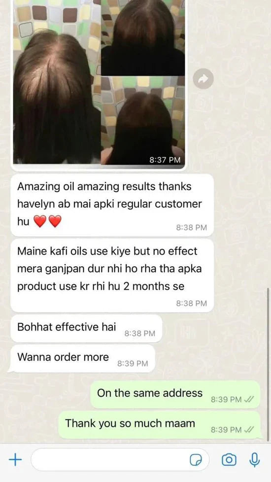 Original Havelyn Hair Food Oil of Pakistan ★4.8/5|10000+ Verified Ratings